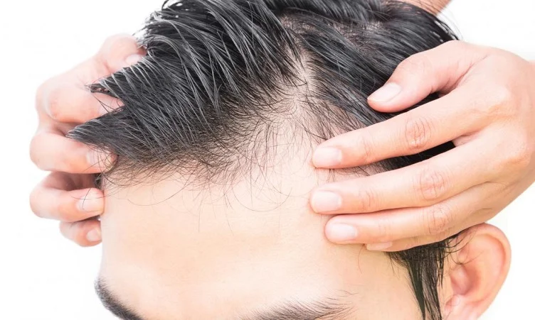 ماساژ پوست سر برای درمان ریزش مو